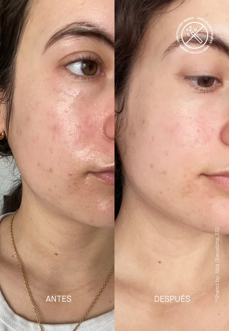 CELAVINE BARRIER RESTORING HYDRATING CREAM 50ml - كريم ترميم حاجز البشرة من سيلافين