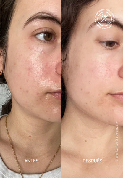 CELAVINE BARRIER RESTORING HYDRATING CREAM 50ml - كريم ترميم حاجز البشرة من سيلافين