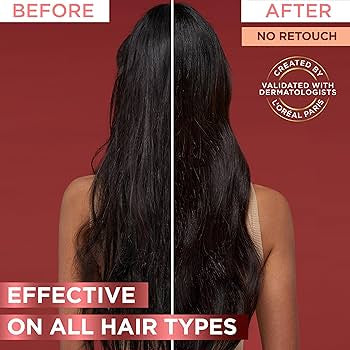 L'Oréal elvive shampoo fortalecedor 360ml - شامبو لوريال باريس المقوي للشعر التالف والجاف