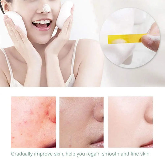 Bio Blend Purifying Facial Cleansing Gel (Salicylic Acid) - غسول جل بحمض السالسليك