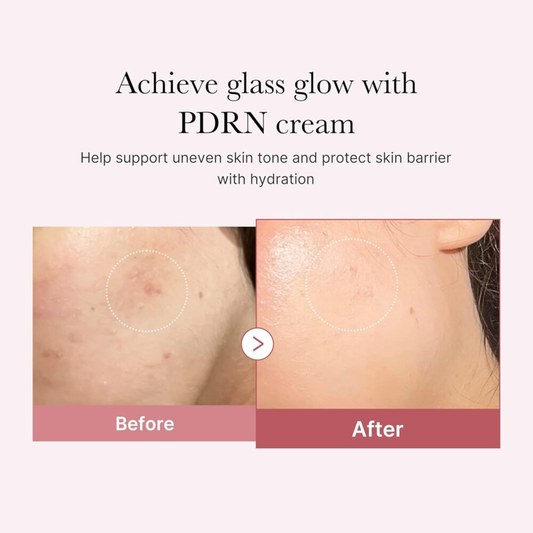 MEDICUBE PDRN Pink Hyaluronic Moisturizing Cream for All Skin Types 50ml
ميدكيوب كريم مرطب بحمض الهيالورونيك لجميع أنواع البشرة
