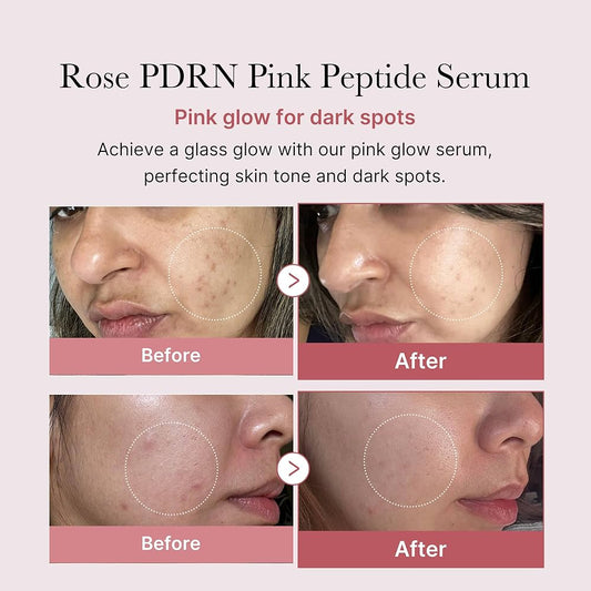 medicube PDRN Pink Peptide Serum 30ml
السيروم الوردي المعزز لإشراقة البشرة