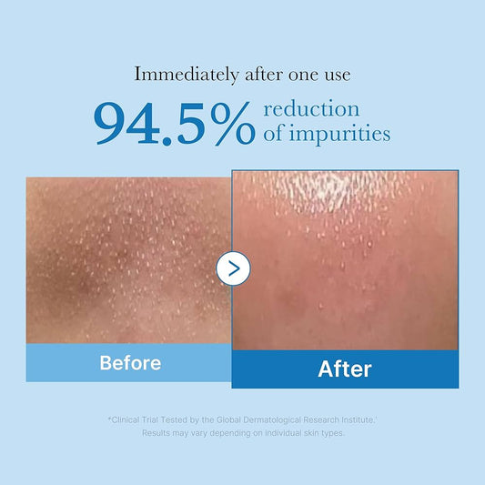 Medicube zero pore blackhead deep cleansing oil 205ml - غسول ميدكيوب الزيتي لتنظيف المسامات