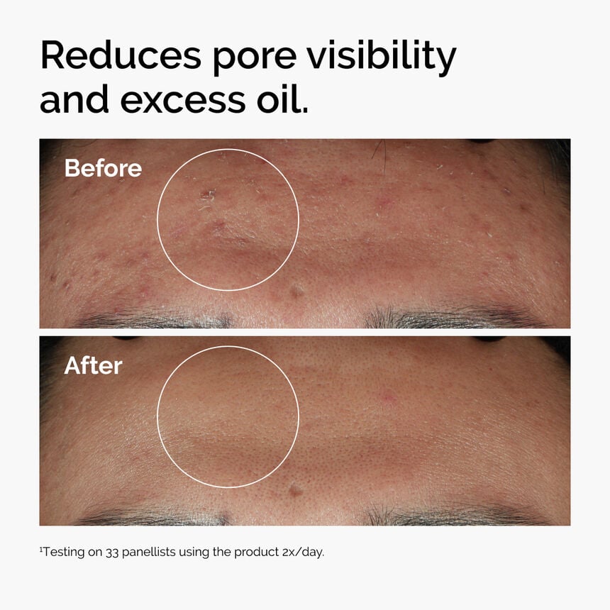 The Ordinary Niacinamide 10% + Zinc 1% Serum⁠ - سيروم النياسنمايد
